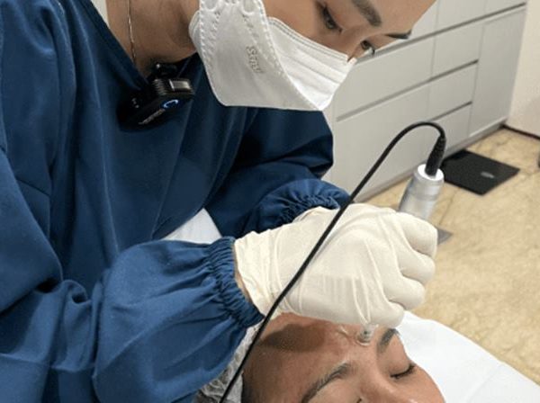 5 Keunggulan Thread Lift Treatment untuk Peremajaan Wajah Tanpa Operasi 2