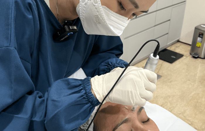 5 Keunggulan Thread Lift Treatment untuk Peremajaan Wajah Tanpa Operasi 2